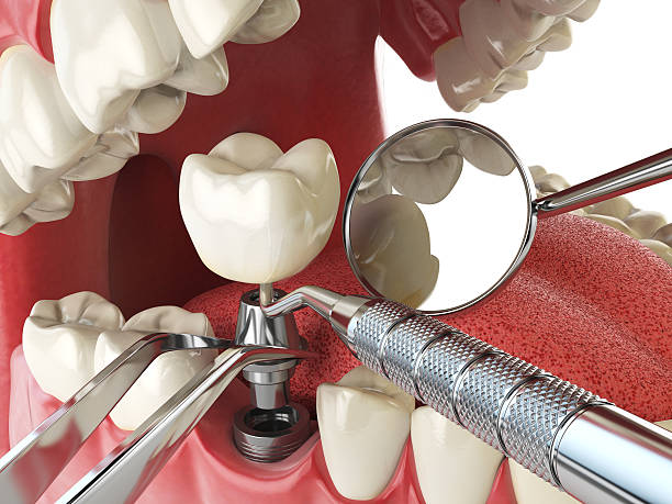 Best Emergency Wisdom Teeth Removal in Childress, TX
